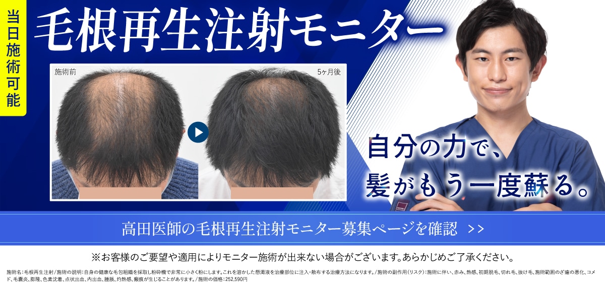 毛根再生モニター募集中 モニター予約はこちら
