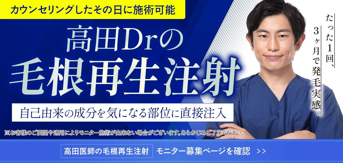 毛根再生モニター募集中 モニター予約はこちら