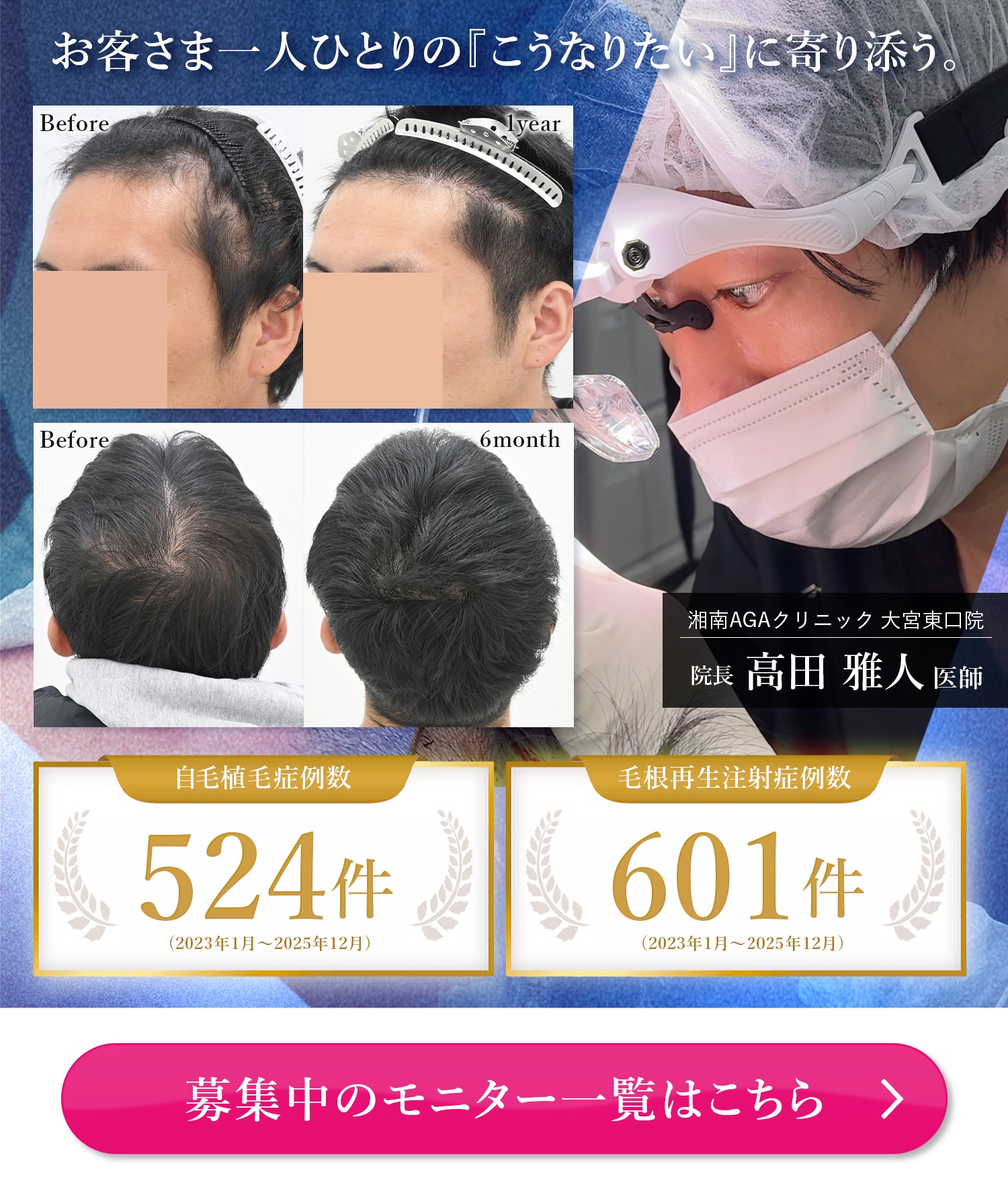 募集中のモニター一覧はこちら