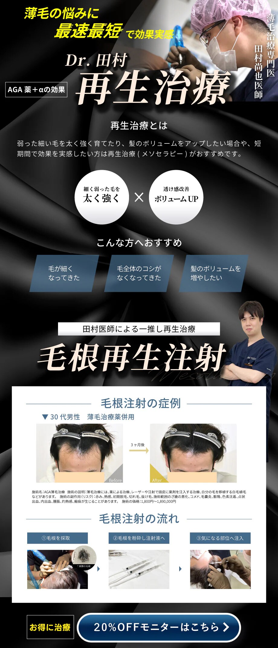毛根再生注射　20%OFFモニターはこちら