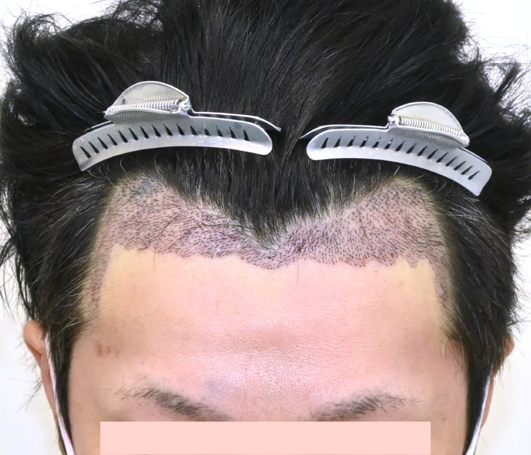 最小限のダウンタイム