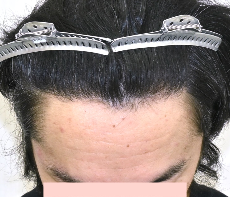 仕上がりの美しさ