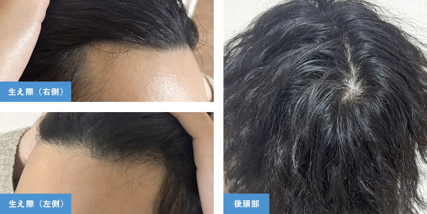 Before After