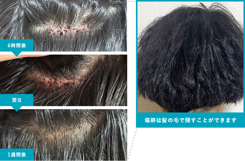 Before After