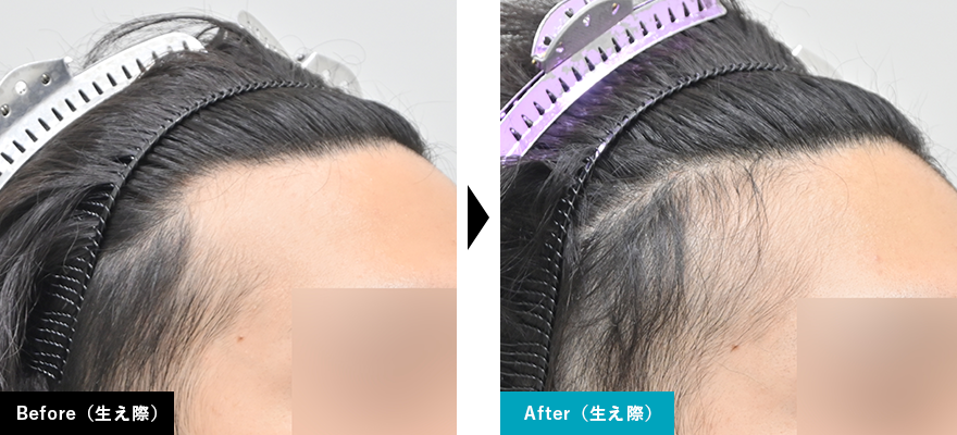 Before After