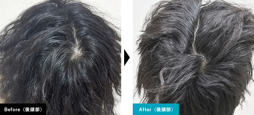 Before After