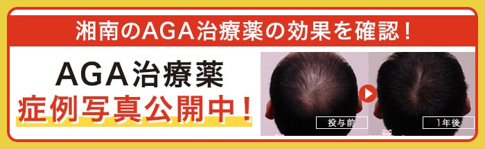 AGA治療薬の症例写真公開中