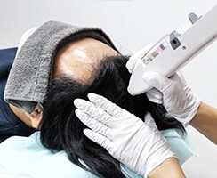 毛髪再生メソセラピー