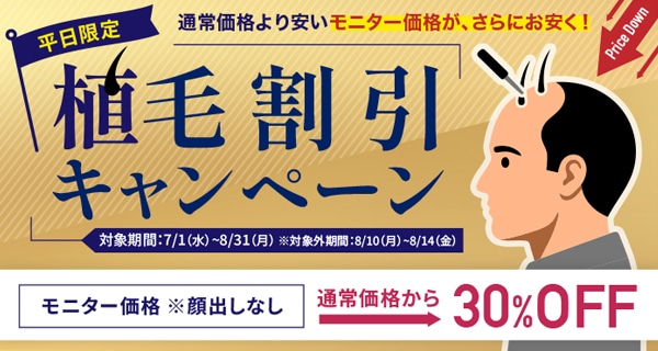 自毛植毛キャンペーン