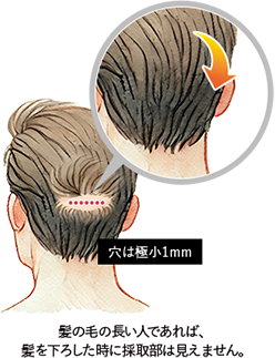 髪の毛の長い人であれば、カモを下ろした時に採取部は見えません。