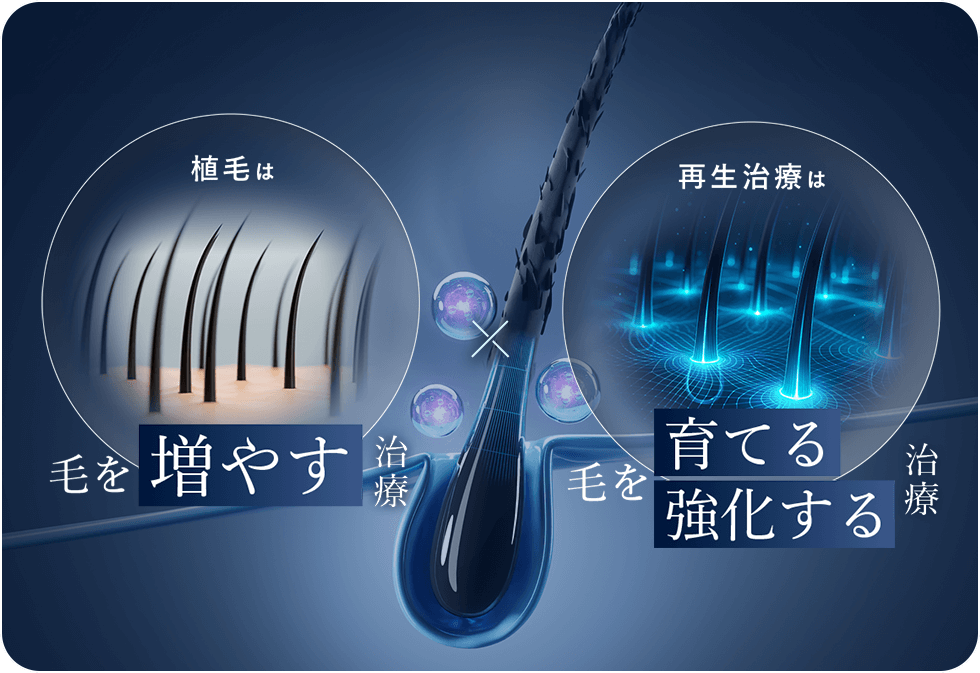 毛を増やす 育てる治療