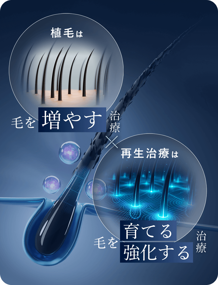 毛を増やす 育てる治療