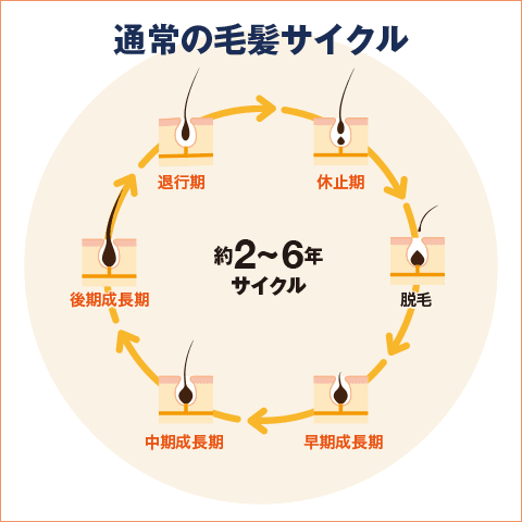 通常の毛髪サイクル / 「→退行期→休止期→脱毛→早期成長期→中期成長期→後期成長期→」約2～6年サイクル
