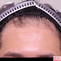 症例写真03