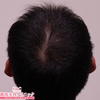 症例写真06