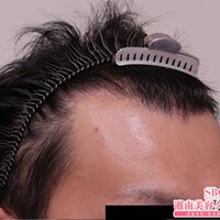 症例写真07