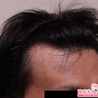 症例写真08