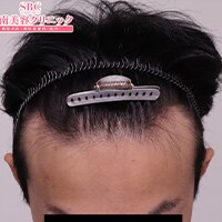 症例写真09