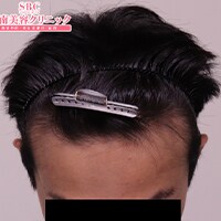症例写真10