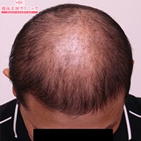 症例写真11