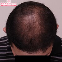 症例写真12