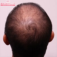 症例写真13