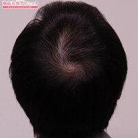 症例写真15