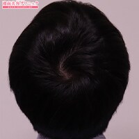 症例写真16