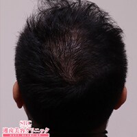 症例写真17