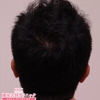 症例写真18