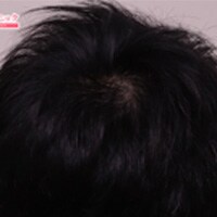 症例写真22