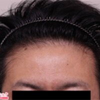 症例写真24