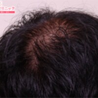 症例写真25