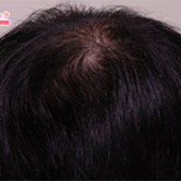 症例写真26