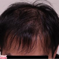 症例写真28