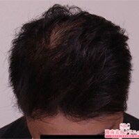 症例写真29