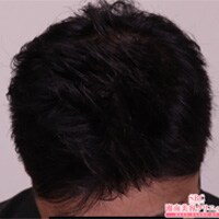 症例写真30