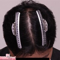 症例写真32