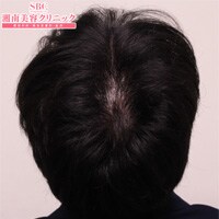 症例写真35