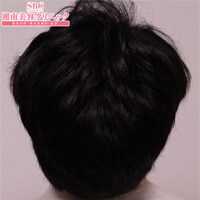 症例写真36