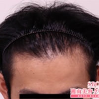 症例写真37
