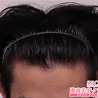 症例写真38