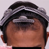 症例写真47