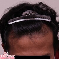症例写真48