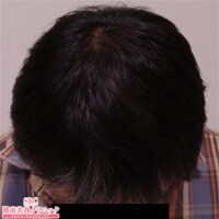 症例写真50