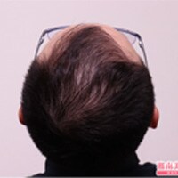 症例写真51
