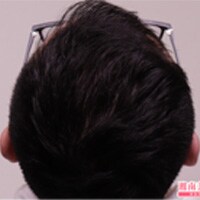 症例写真52