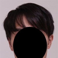症例写真53