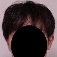 症例写真54