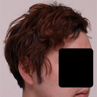 症例写真56